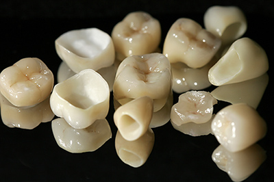 zirconia-زیرکونیا در دندانپزشکی