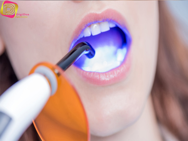 لایت‌ کیور آشنایی با لوازم دندانپزشکی پرکاربرد به زبان ساده